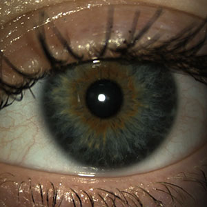 Close up of an eye during an eye test